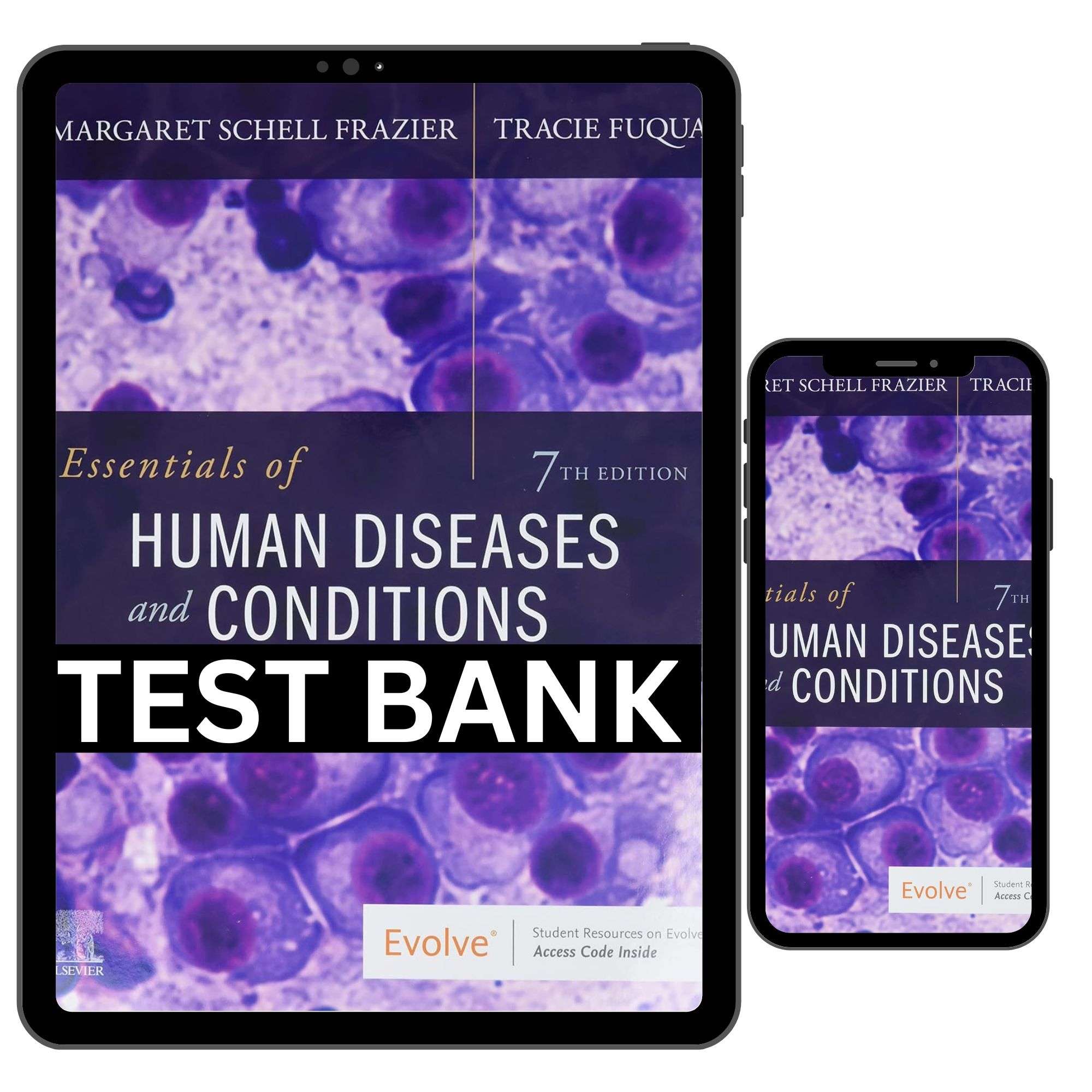 Essentials-Of-Human-Diseases-And-Conditions-7th-Edition-By-Frazier-Test-Bank.jpg